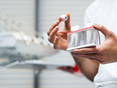 A person holding a tray with multiple toothbrushes, likely in a dental care setting.
