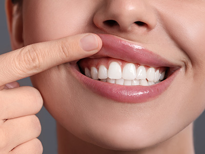 A person with straight white teeth is holding their finger up to their nose while smiling broadly.