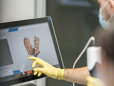 A person wearing gloves is interacting with a digital display showing an image of a dental implant.