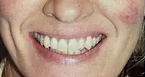 The image shows a person smiling at the camera with teeth visible, wearing makeup on their face, and there s a close-up of another person s face partially visible in the bottom right corner.