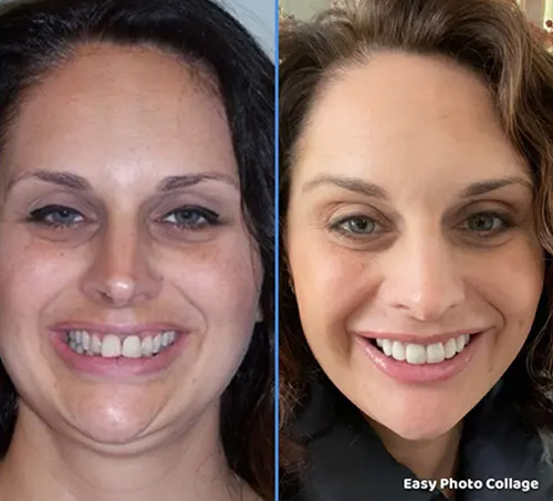 The image shows a woman with three different facial expressions, displayed side by side.