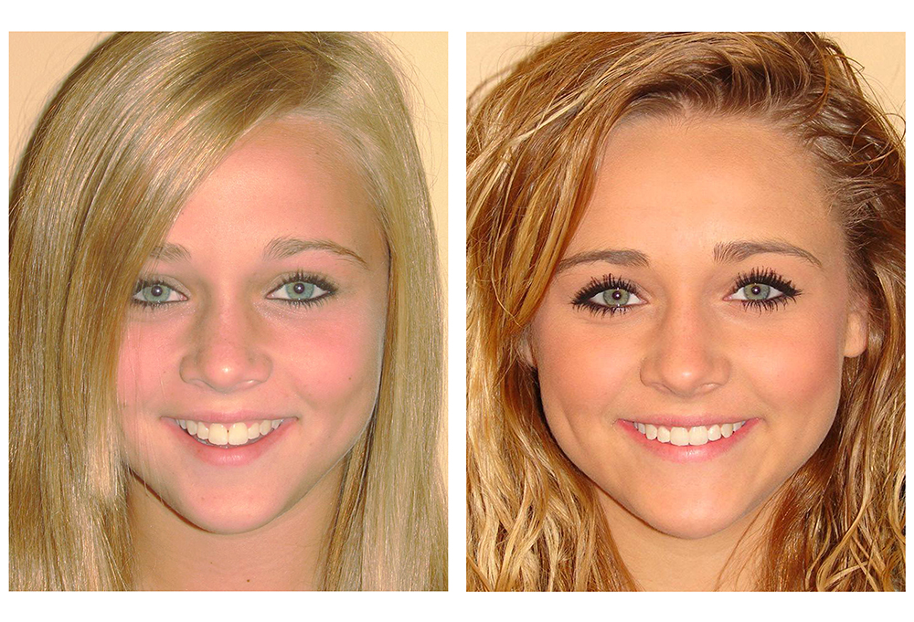 Granby Dental Center